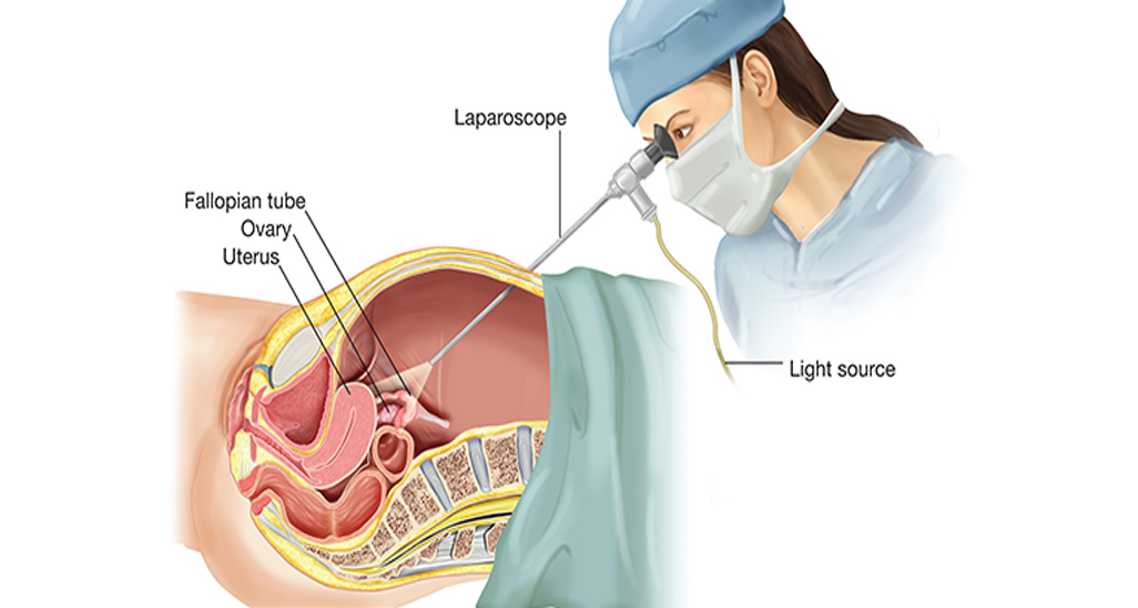 Laparoscopic Surgeon in Gwalior